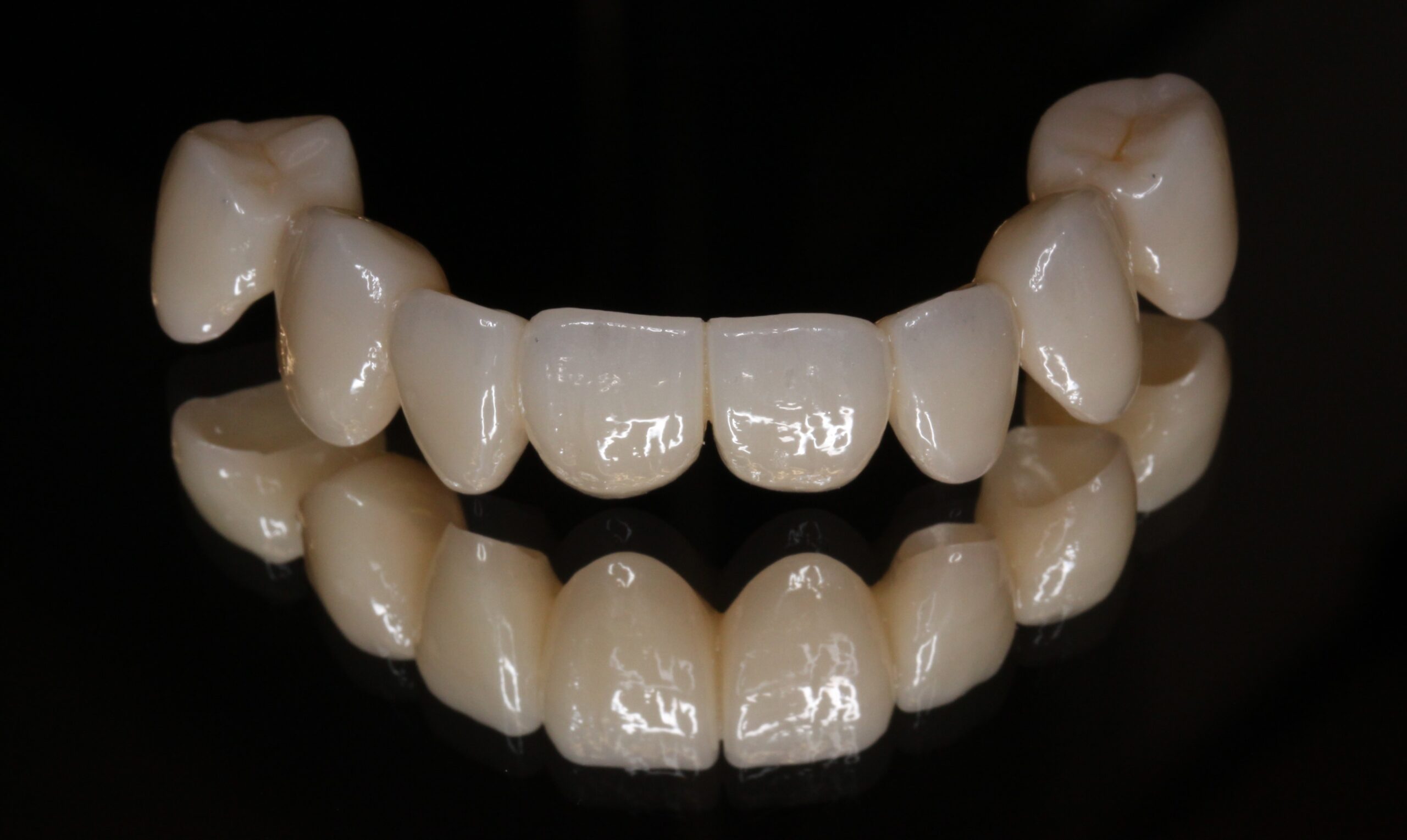 審美歯科　フルジルコニアブリッジ