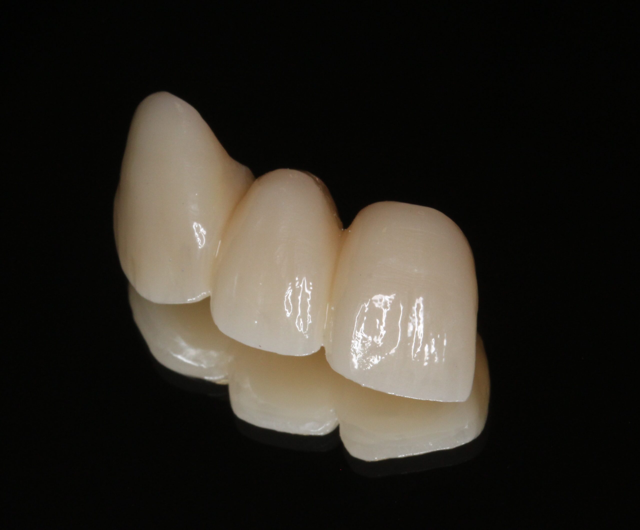 審美歯科　フルジルコニアブリッジ