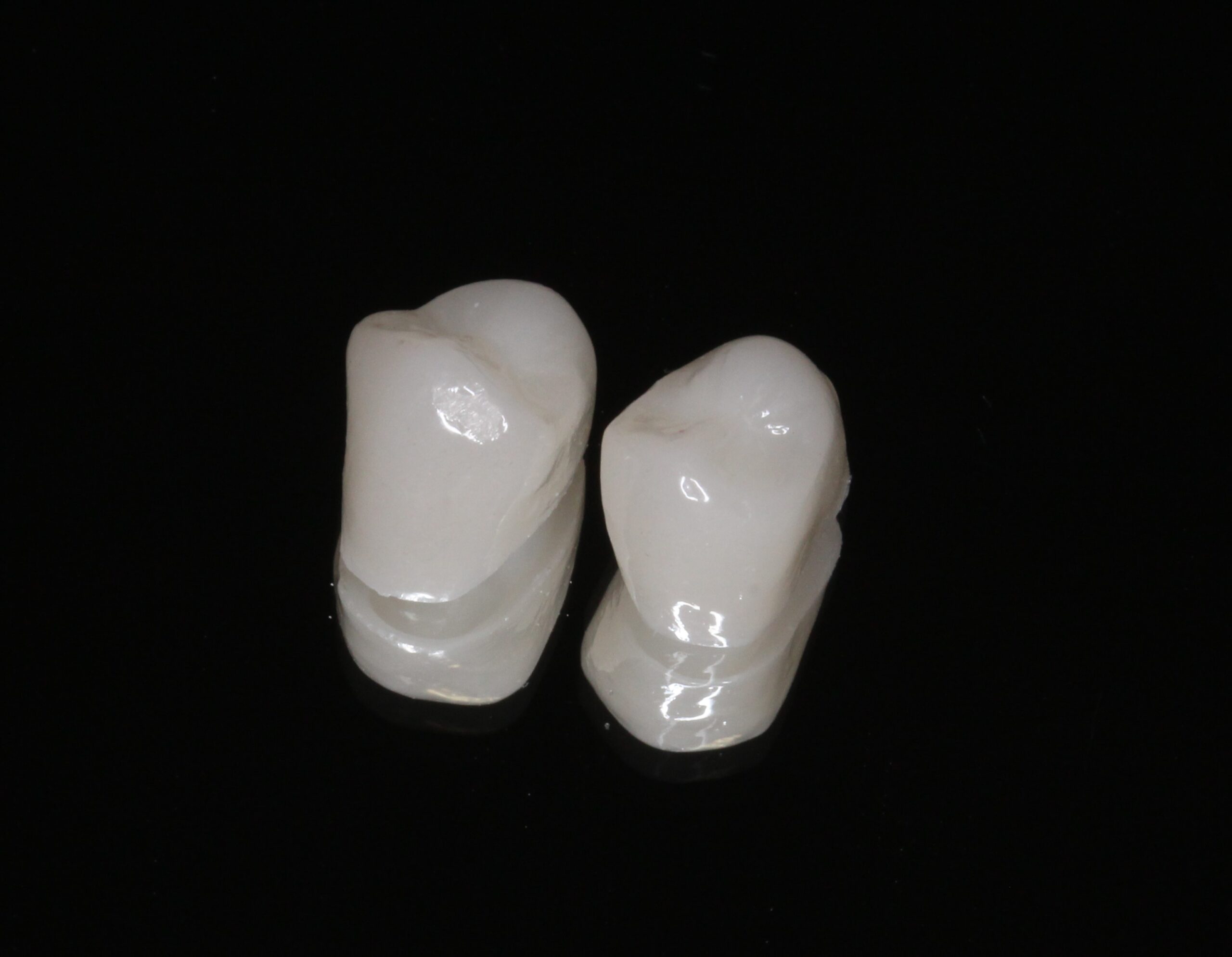 審美歯科　美容歯科　フルジルコニアクラウン