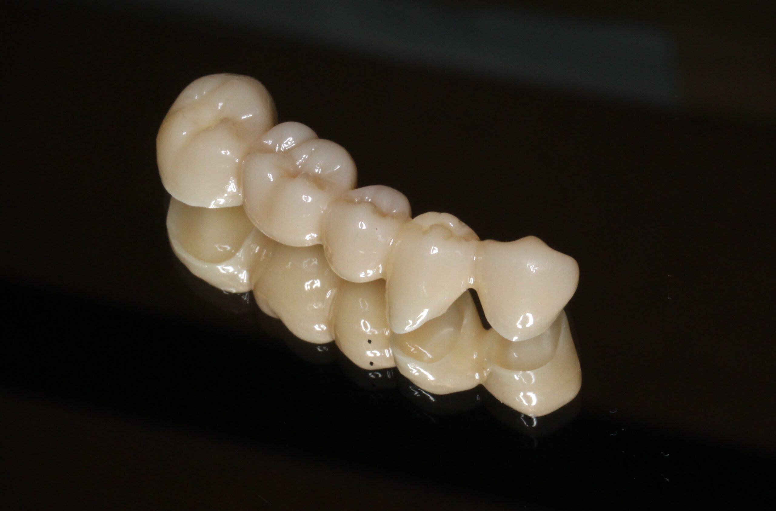 審美歯科　１歯６００００円のフルジルコニアブリッジ