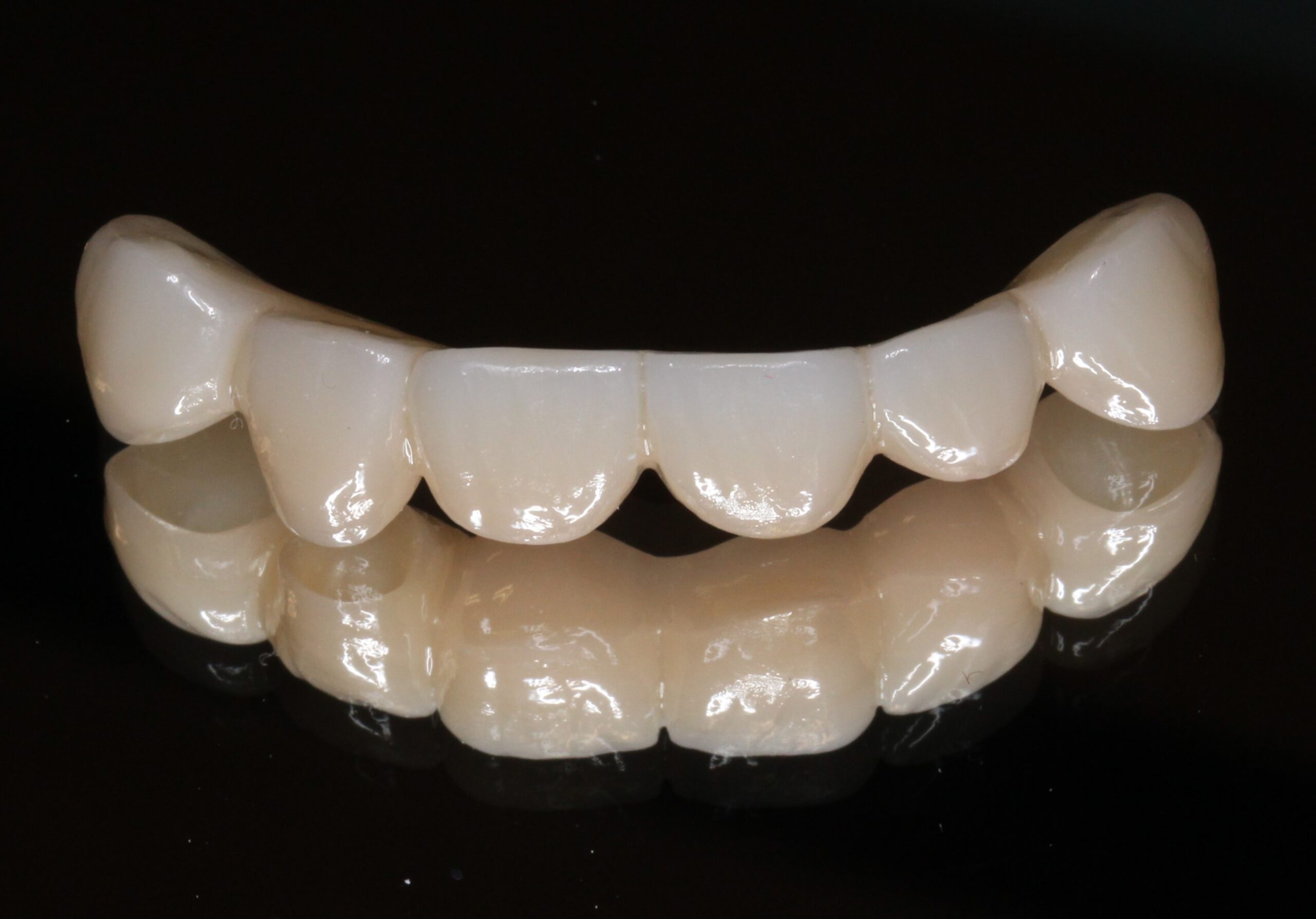 審美歯科　美容歯科　フルジルコニアブリッジ