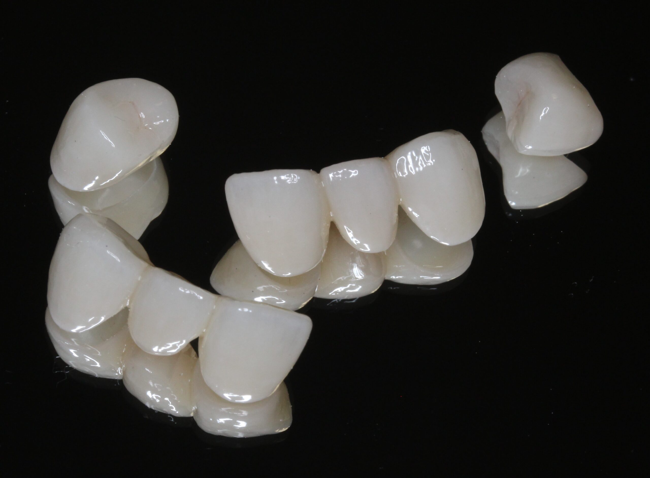 審美歯科　美容歯科　８前歯　フルジルコニアクラウン