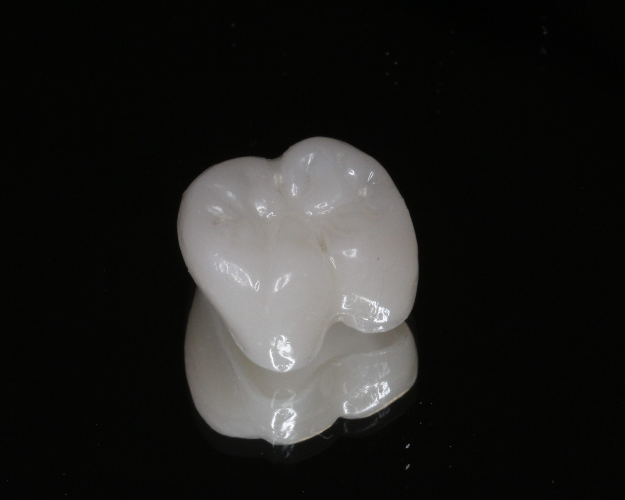 審美歯科　美容歯科　フルジルコニアクラウン