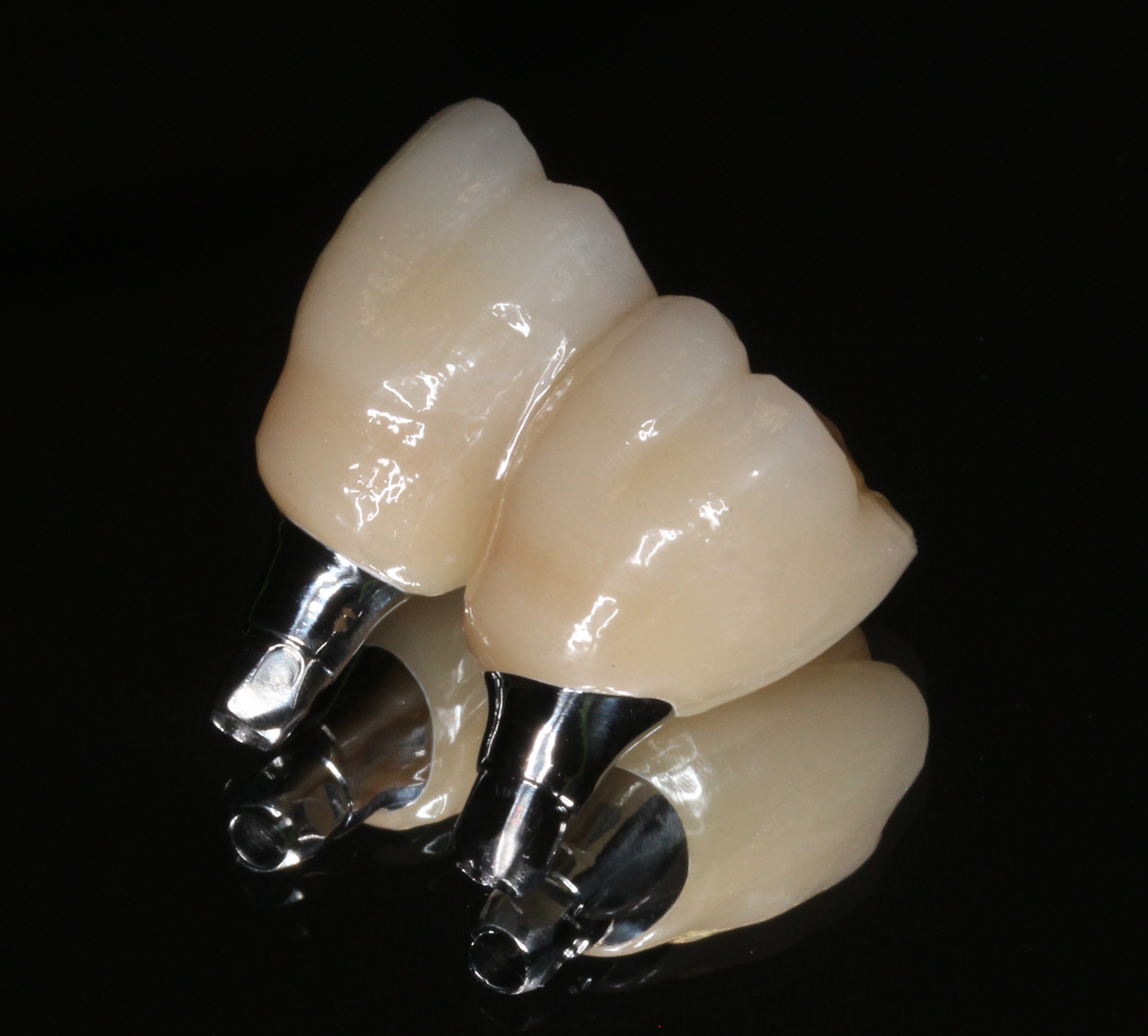 インプラント　フルジルコニアクラウン