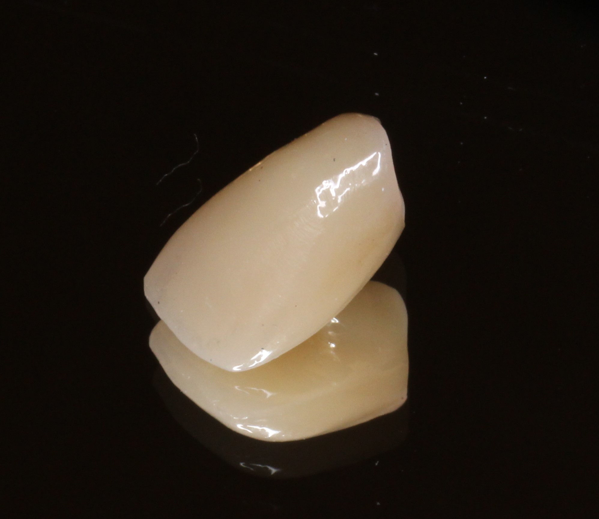 審美歯科　美容歯科　フルジルコニアクラウン