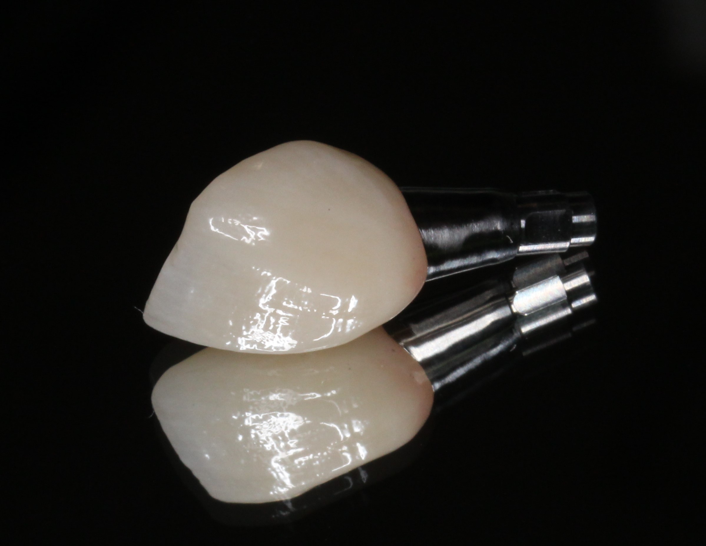 インプラント　前歯　フルジルコニアクラウン