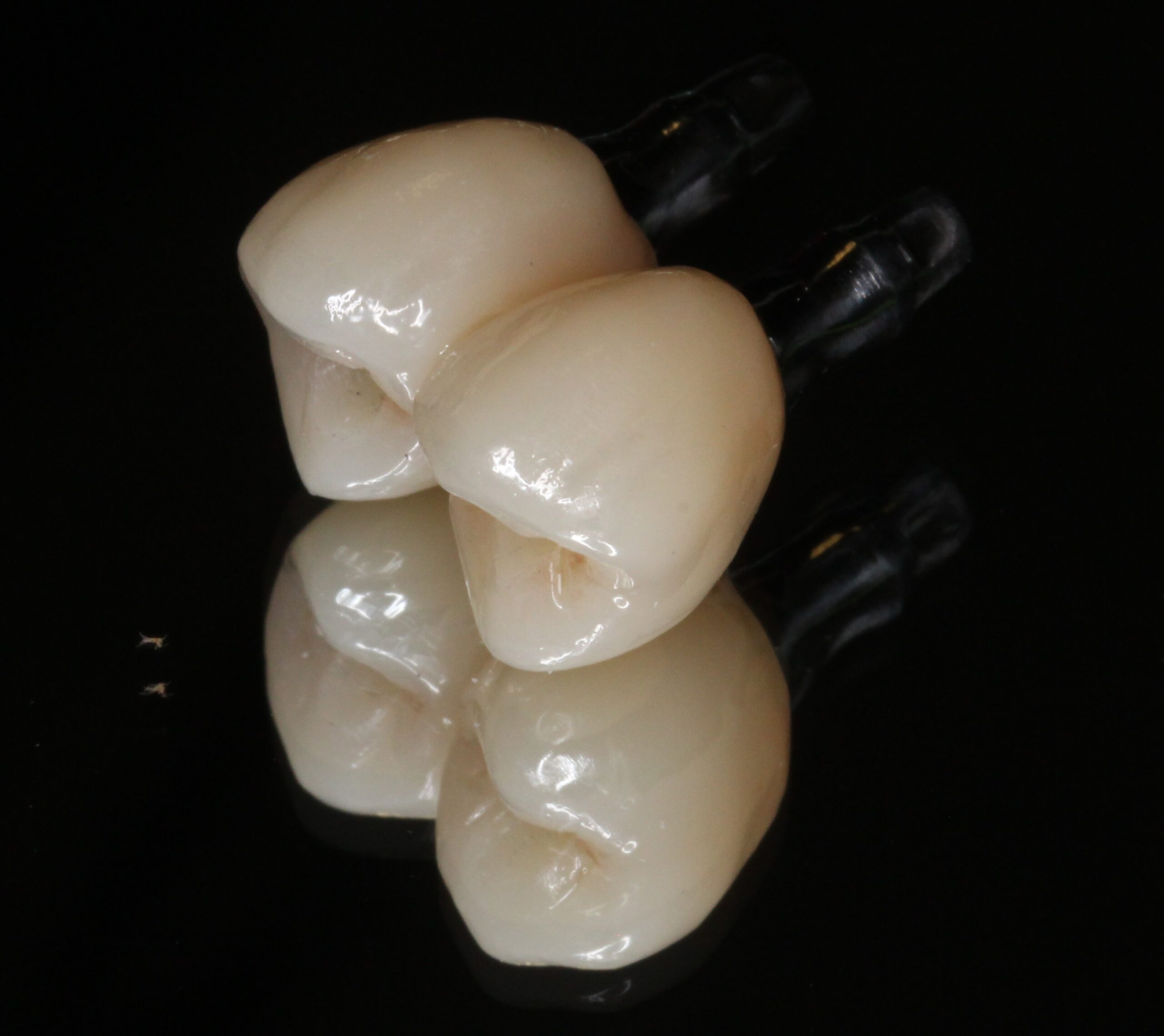 インプラント　小臼歯　フルジルコニアクラウン