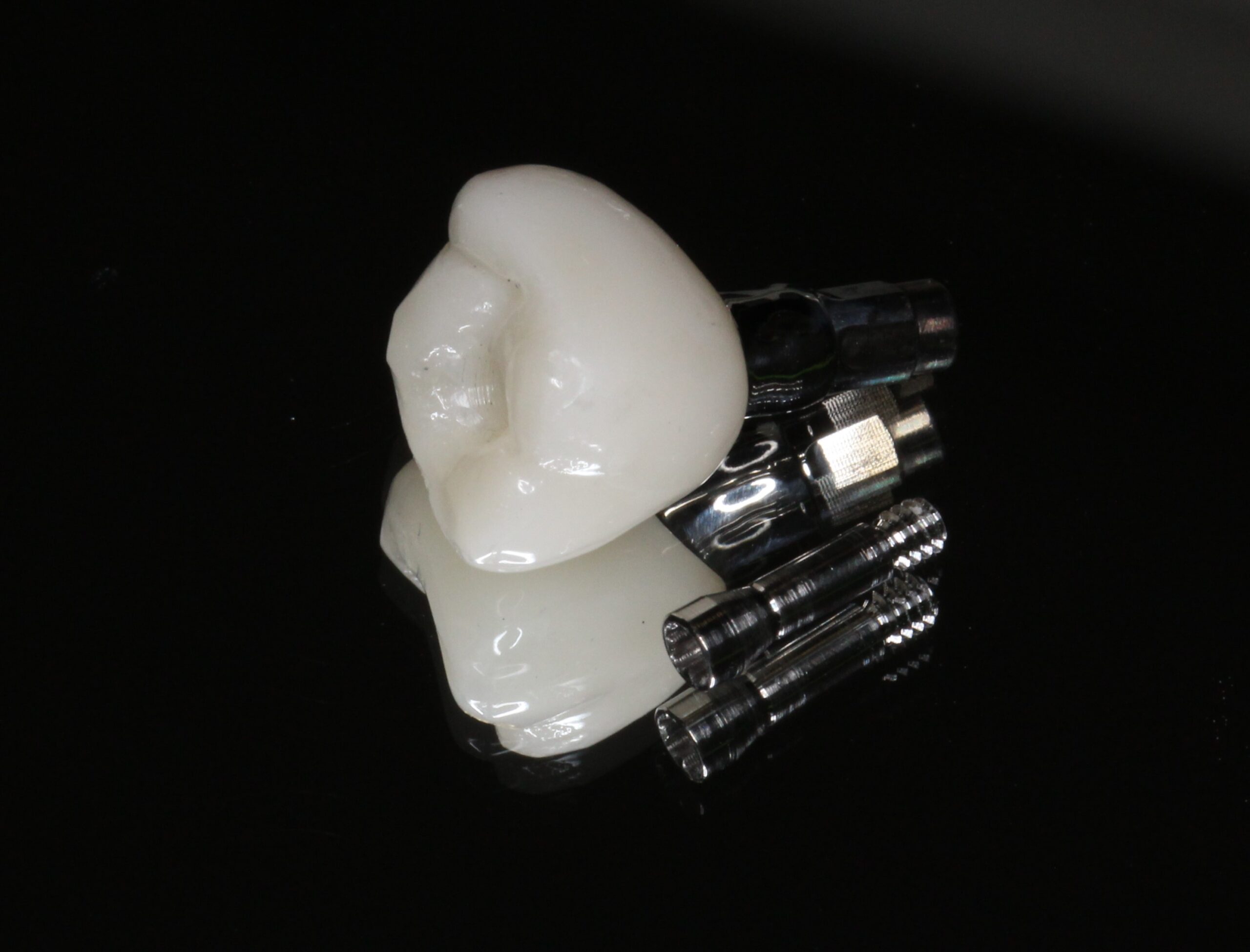 インプラント　スクリュー固定　ジルコニア　ブリーチ色