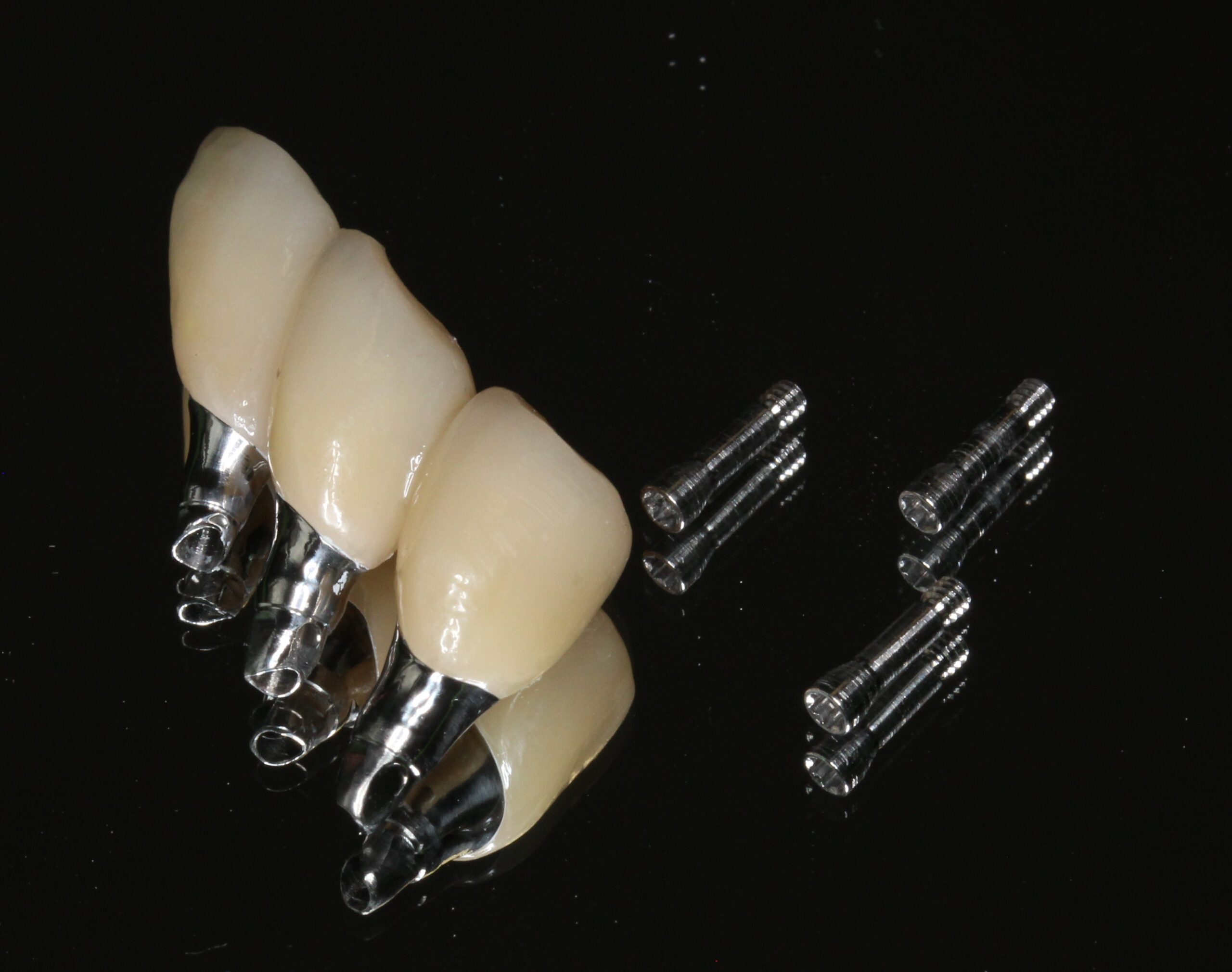 インプラント　フルジルコニア　スクリュー固定　